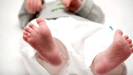Air trop sec: problème de peau bébé